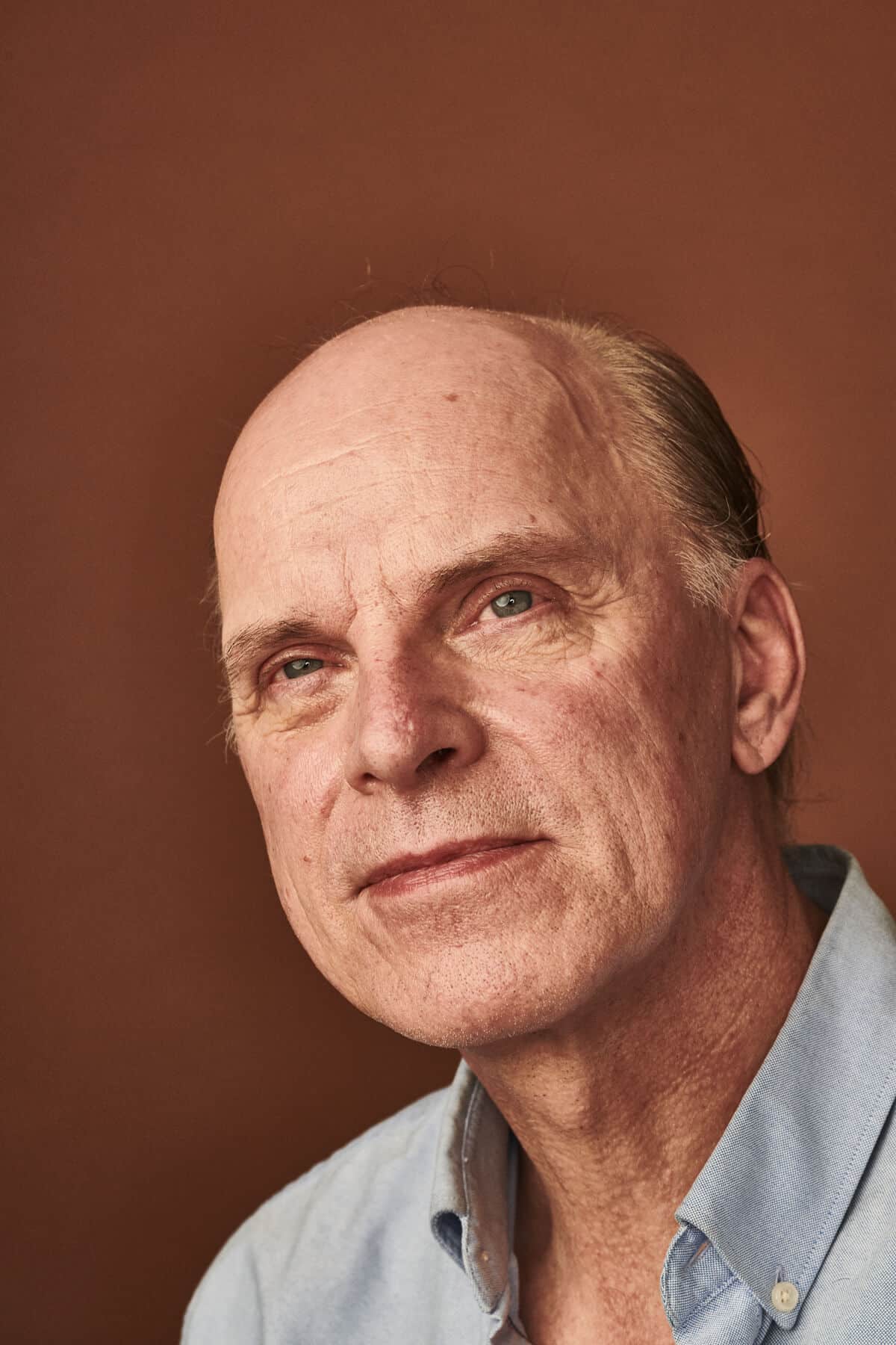 Patient behandlet med Mohs kirurgi på næsen